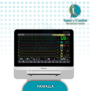 Monitor de Signos Vitales BeneVision N15 | Mindray