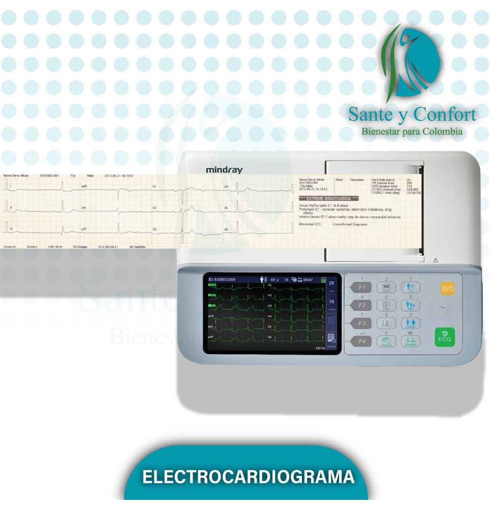 Electrocardiógrafo 3 Canales BeneHeart R3 | ECG Portátil