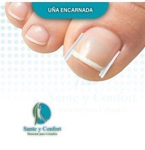 uña encarnada