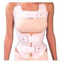 Corsé de Chêneau para escoliosis | Corrección tridimensional