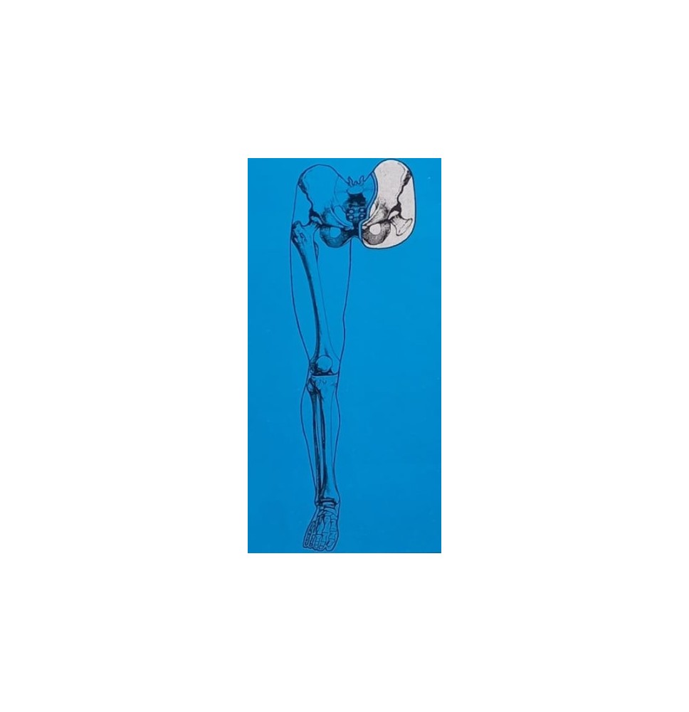 pierna completa protesis
